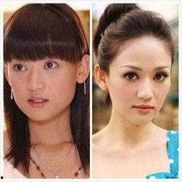 明星都是什么隆鼻,揭秘那些令人惊艳的隆鼻术