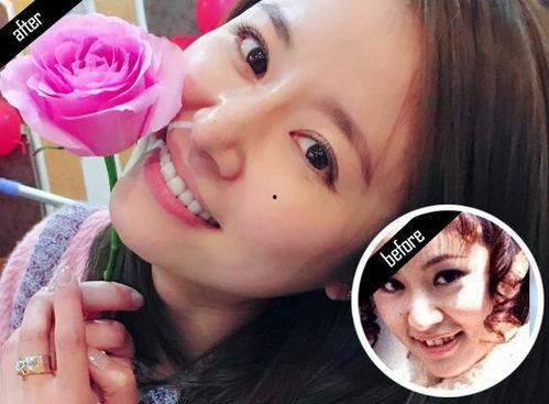 明星美容牙,揭秘明星们的完美笑容秘密